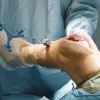 Bpositive